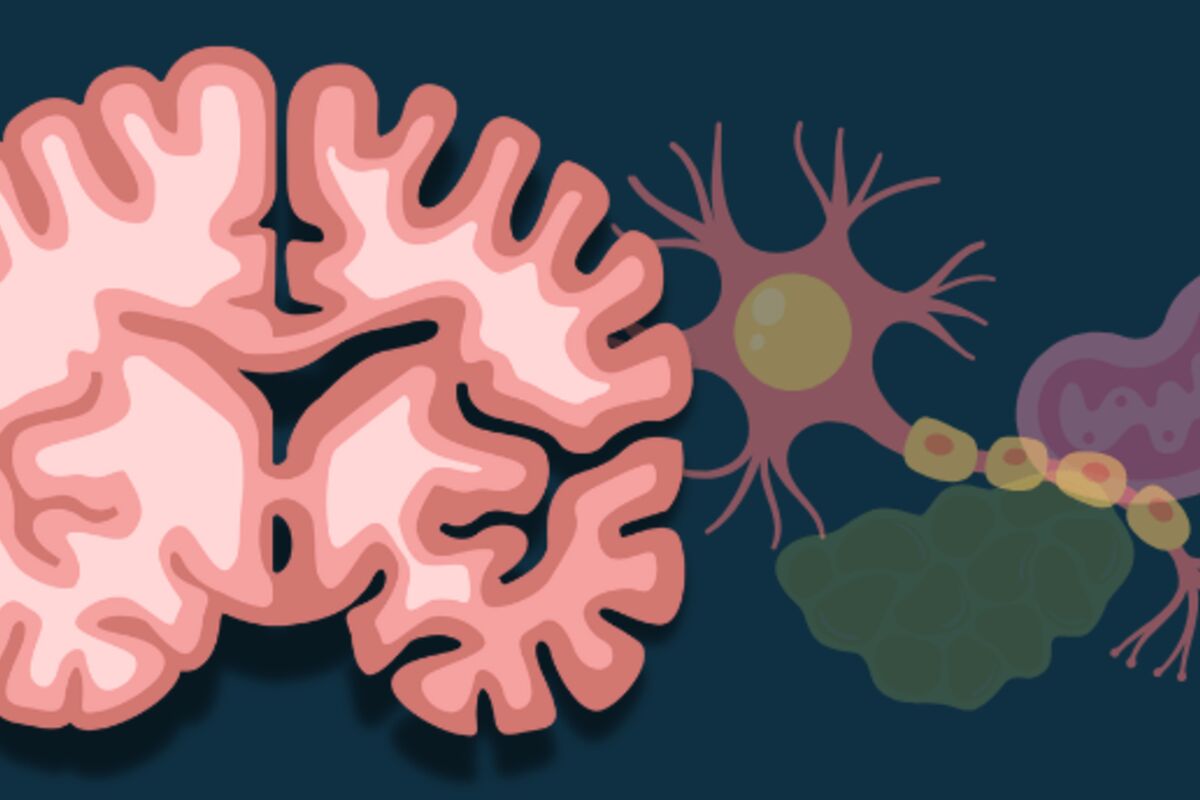 alzheimer's disease